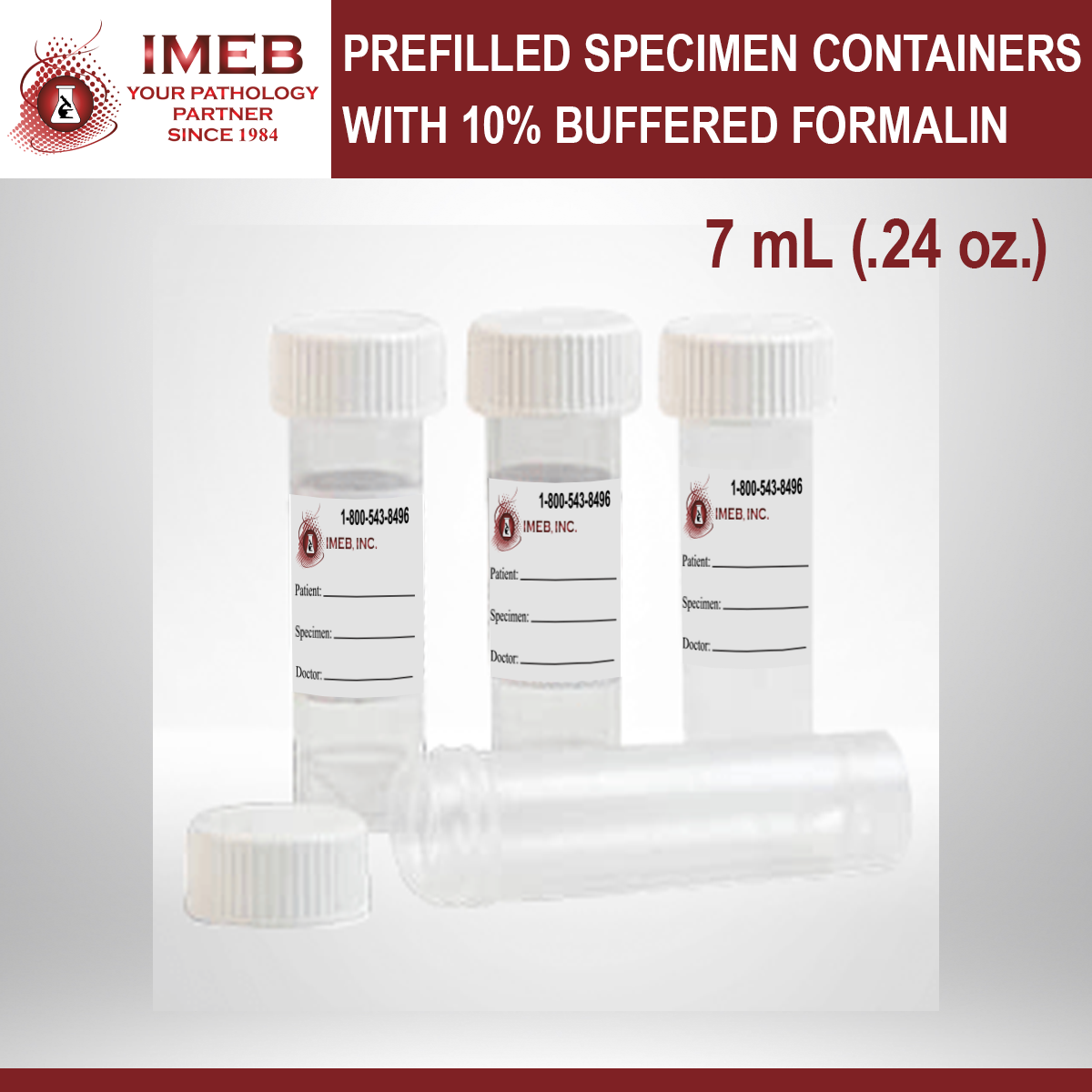7 mL buffered formalin in peti vials