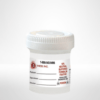 90 mL 10 percent buffered formalin in a lockable container
