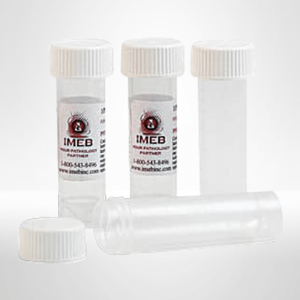 750 mL 10 percent buffered formalin