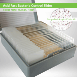 Acid Fast Control Slides