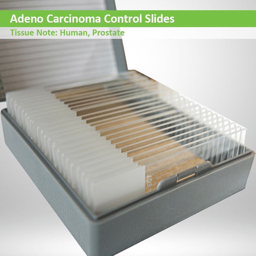 Adeno Carcinoma Control Slides