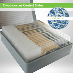 Cryptococcus Control Slides