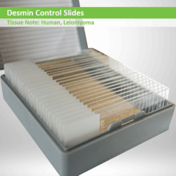 Desmin control slides CS051