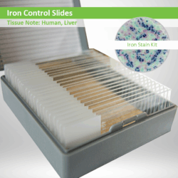Iron Control Slides