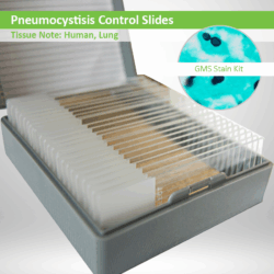 Pneumocystis Control Slides