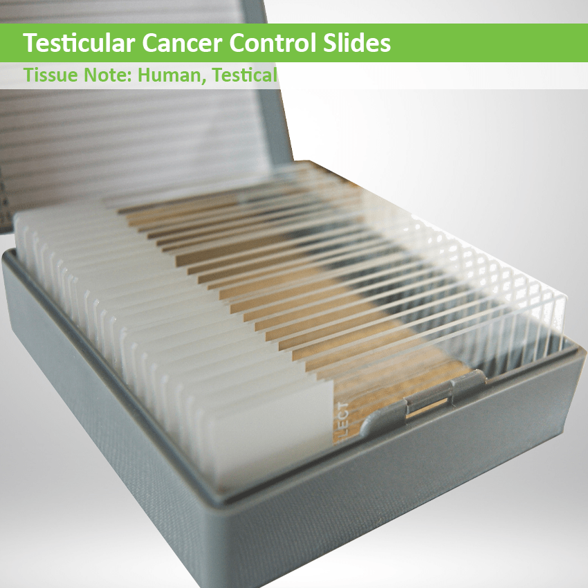Testicular Cancer Control Slide Set