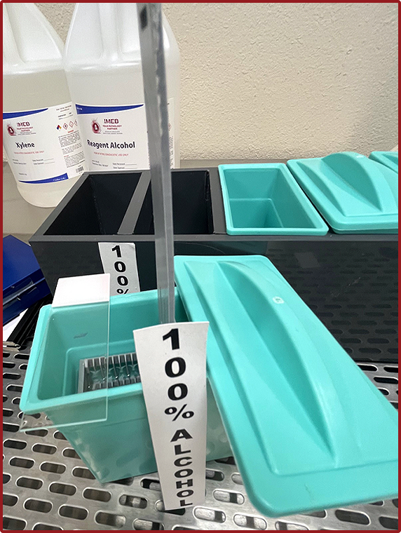 Image of 100 percent alcohol