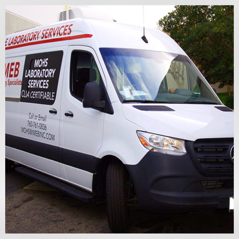 Mohs Mobile van by IMEB Inc. side
