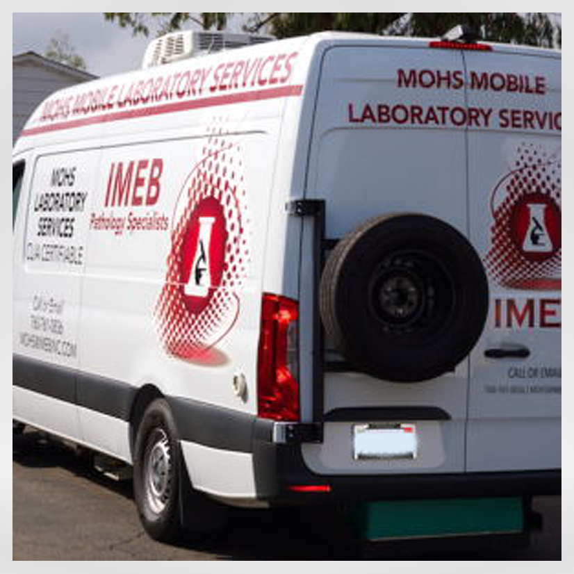 Mohs Mobile van by IMEB Inc. rear