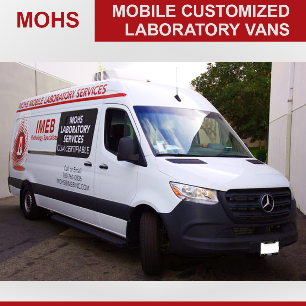 Mohs van front view